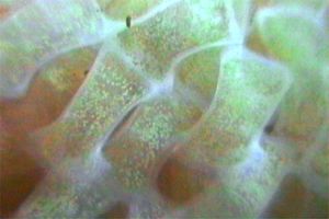 Casside (Phalium granulatum)